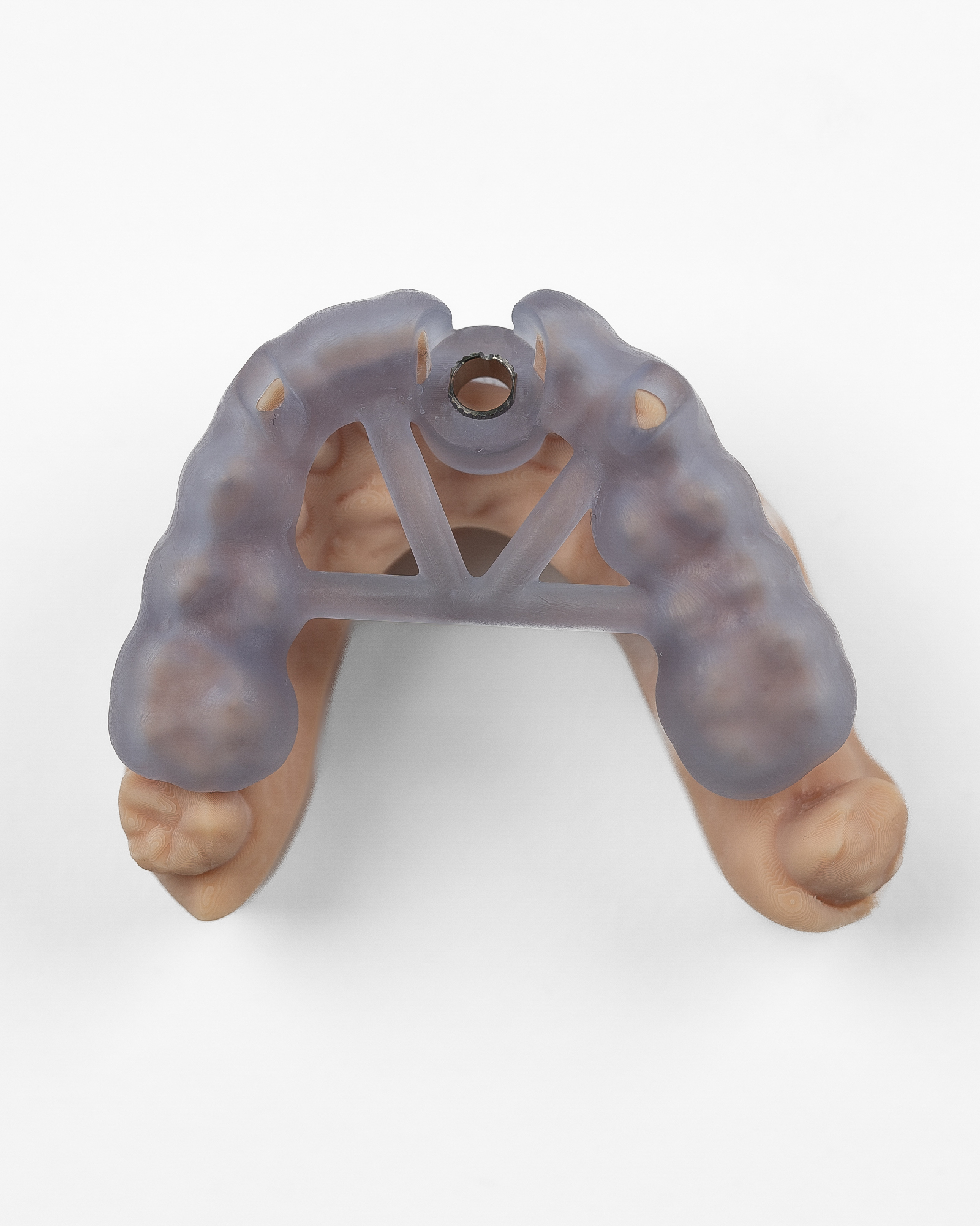Printed Surgical Guide